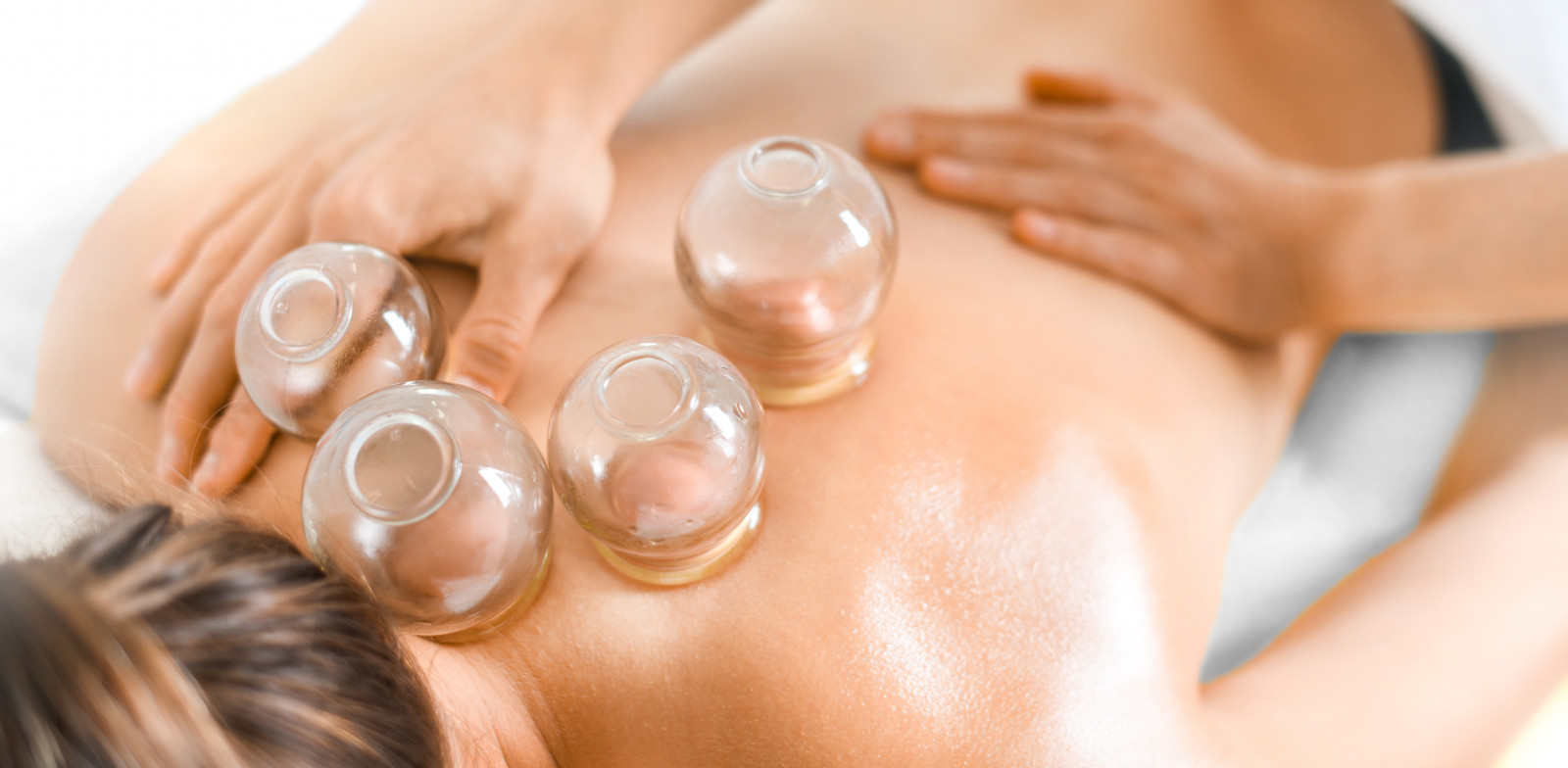Cupping therapy